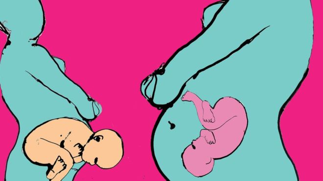 Vaginal birth and Caesarean: Differences in babies